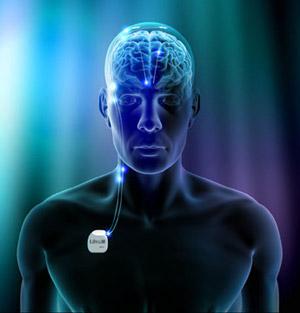 Deep Brain Stimulation Devices Market For Parkinson's Disease To Be ...