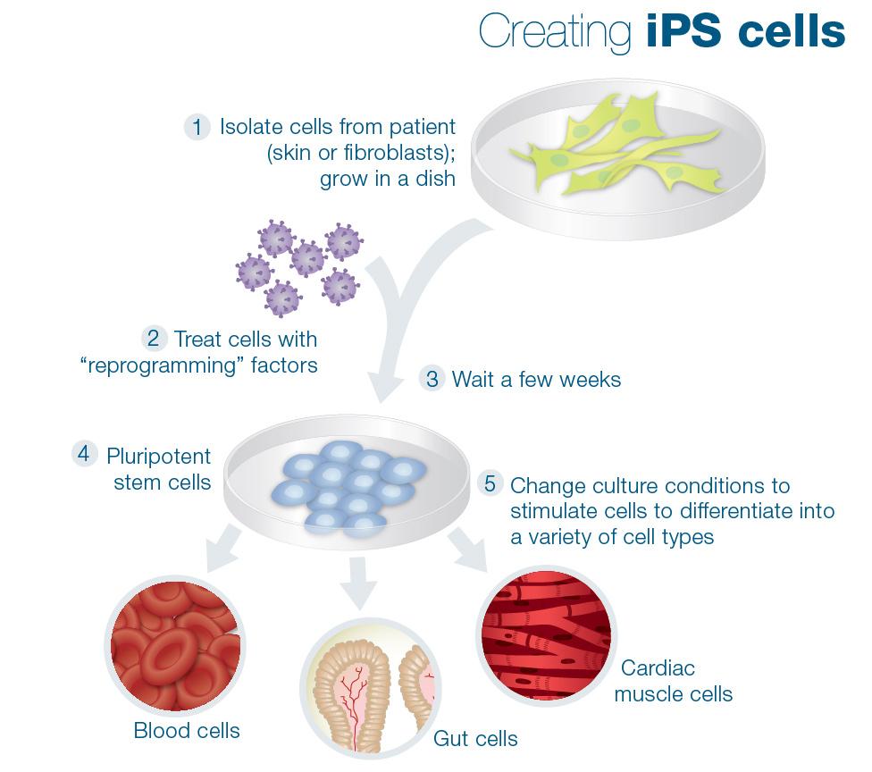 autologous induced pluripotent stem cells