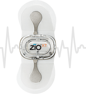 zio heart monitor cost zio heart monitor cost