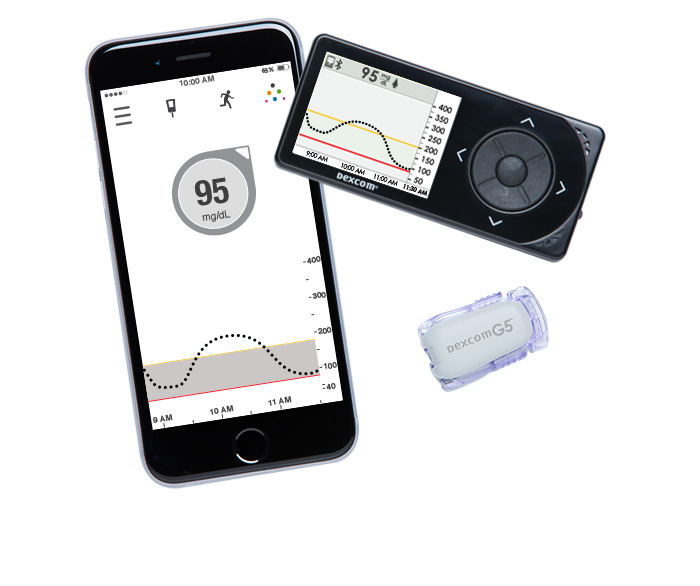 Dexcom cgm