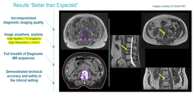 clearview mri vs epic