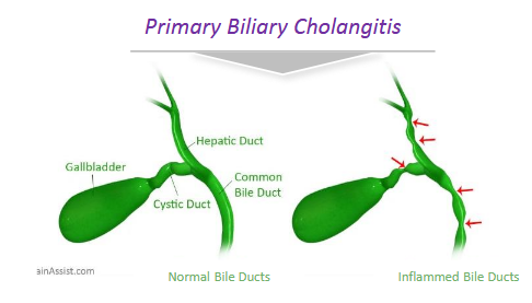 Gilead In PBC: The Clinical Pursuit For Dominance (NASDAQ:GILD ...