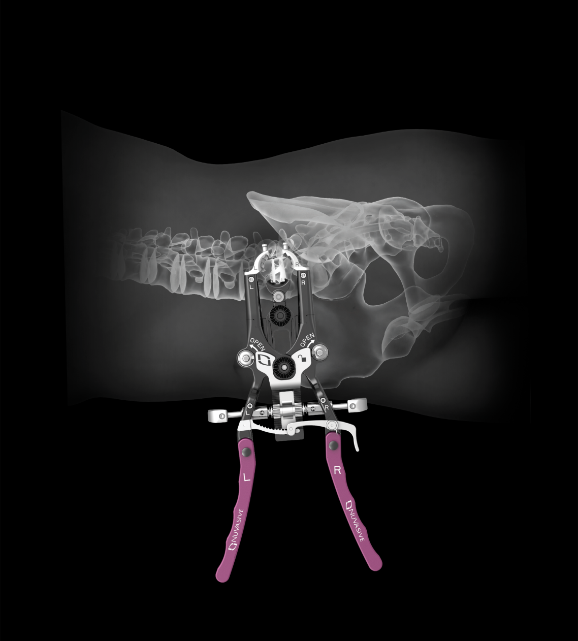 NuVasive Prognosis Is For A 25 Gain (NASDAQNUVADEFUNCT2714