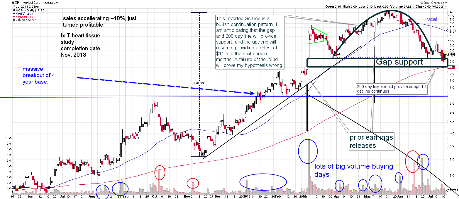 VCEL Technical Analysis: Inverted Scallop Pattern Signalling Uptrend ...