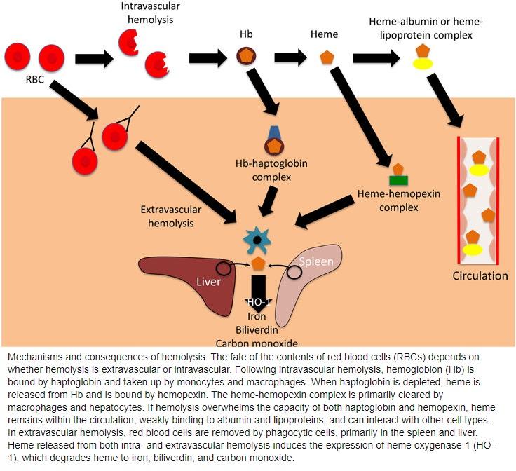 Apellis: Potential Headache For Alexion (NASDAQ:APLS) | Seeking Alpha