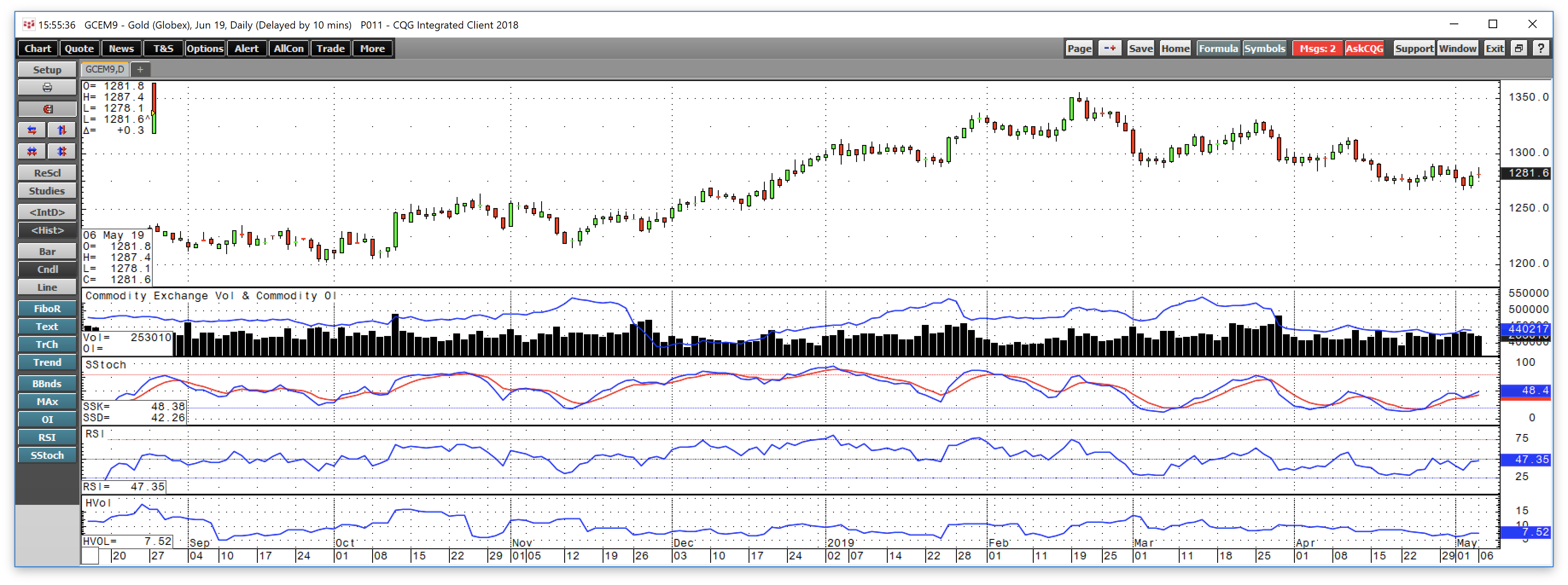 Gold Sits And Waits For Direction (NYSEARCA:JNUG) | Seeking Alpha