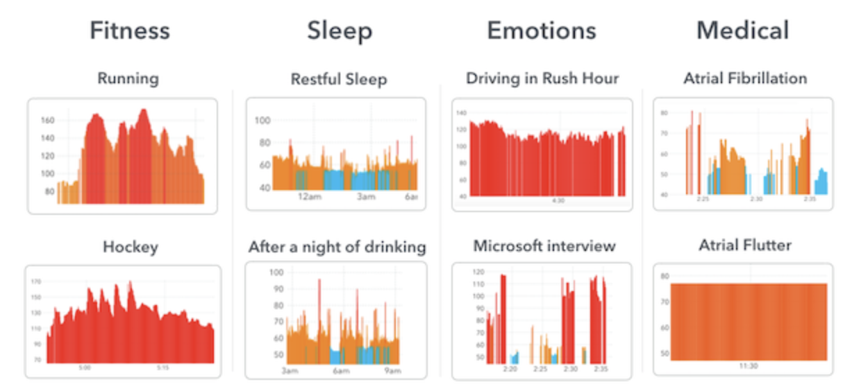 Sleep Apnea Fitbit Chart