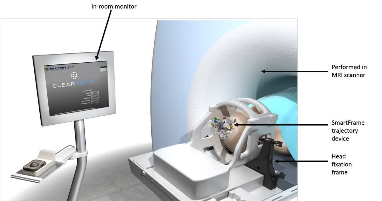 ClearPoint Neuro