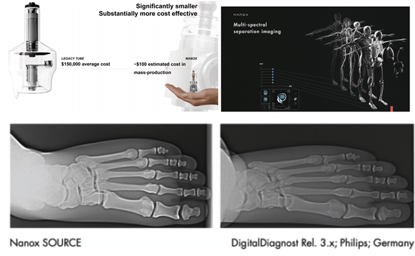 A Critical Look At Nano X Imaging Disruptive Technology With Uncertain Credentials Nasdaq 