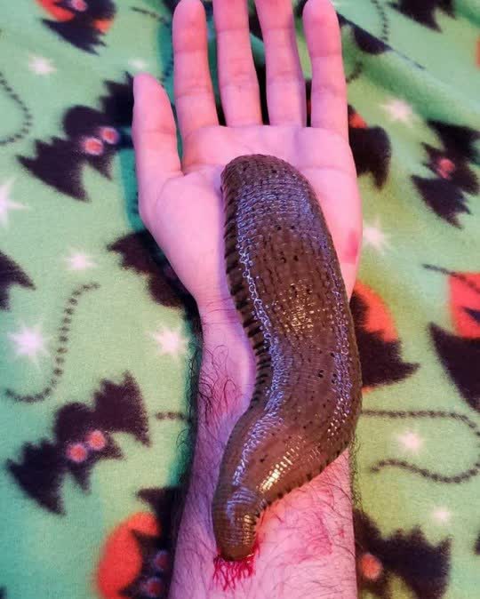 Therapist who lets giant leeches suck his blood says they help him | Metro News