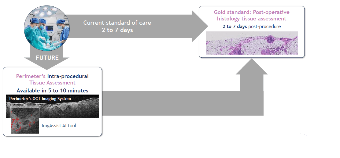 Perimeter Medical Imaging AI: Preventing Surgeries For Breast Cancer ...