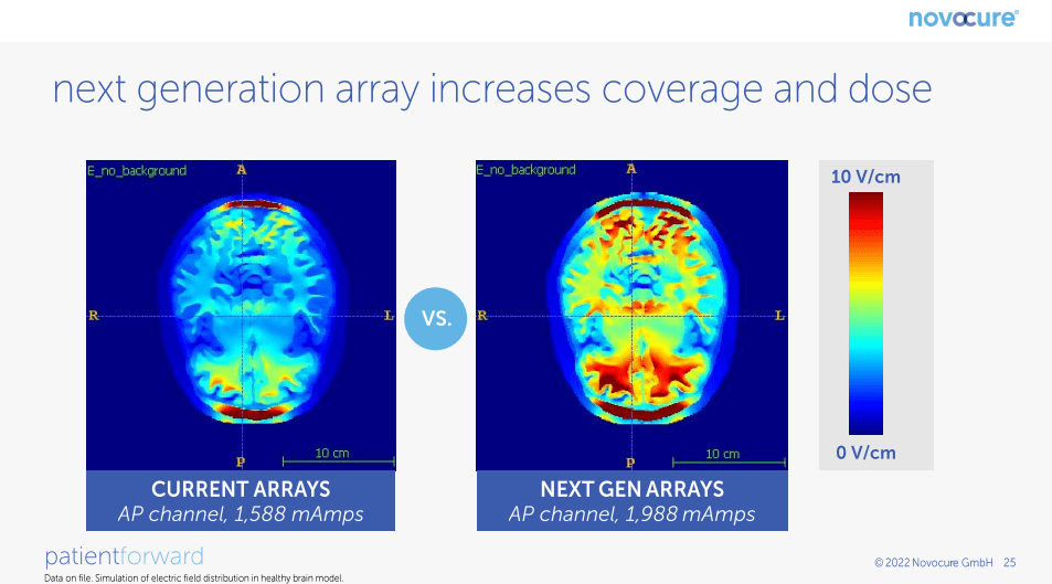 Novocure Array NovoCure Stock: Overview Of The GBM Business (NASDAQ:NVCR) | Seeking Alpha