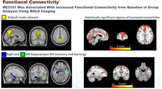 NE3107 Correlation To Brain Functional Connectivity