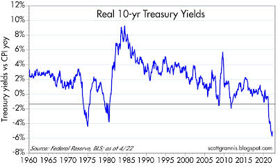 Real 10-year Treasury yields