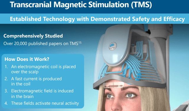 TMS technology