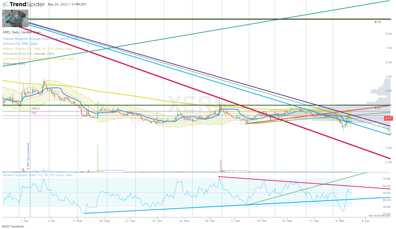 Xeris Biopharma Stock (XERS) Q1 2022 Earnings Reveal Path To Breakeven