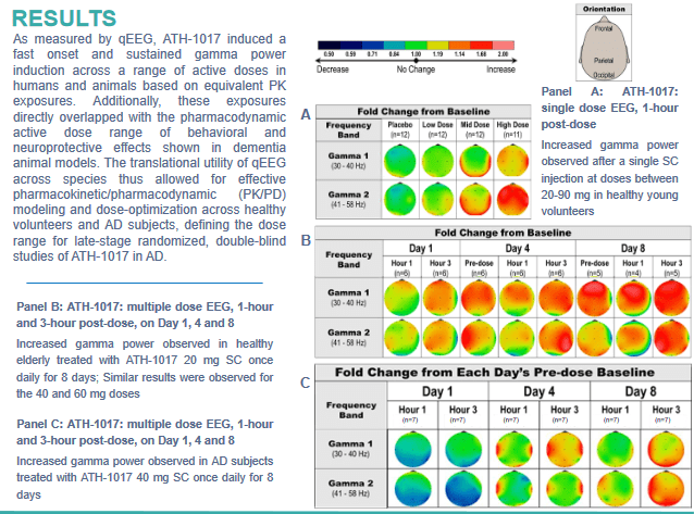 qEEG results