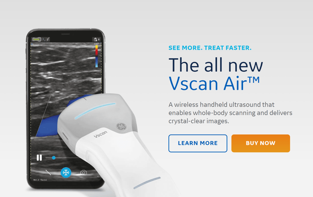GE Health ultrasound scanner