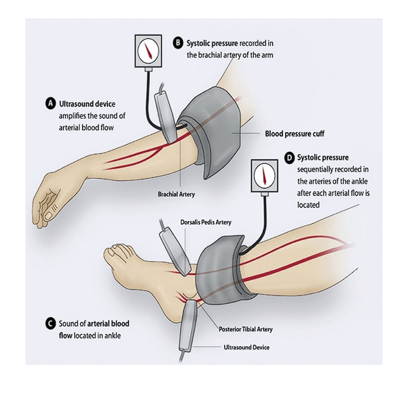 ABI Method