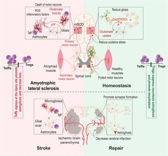 ALS Tregs' Role in Neuroinflammation