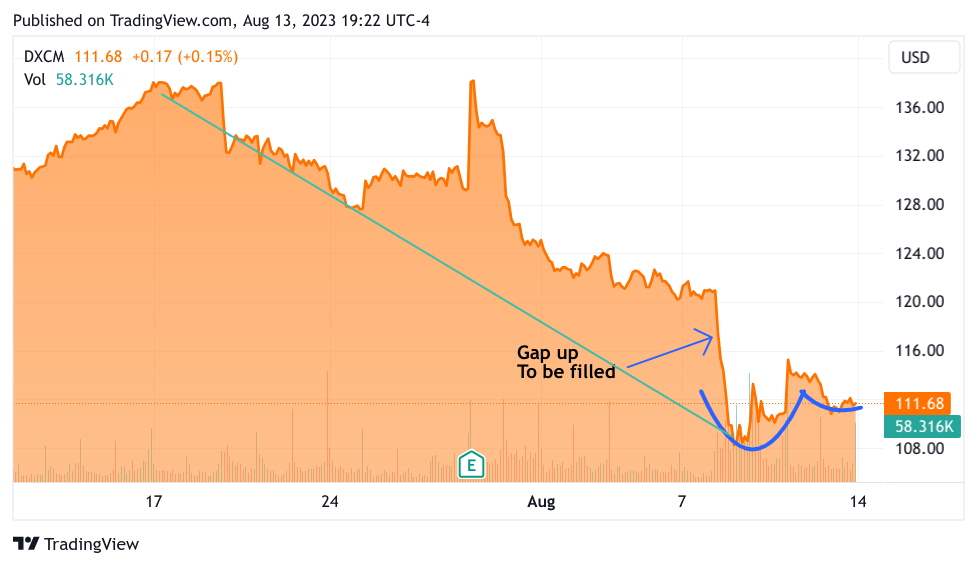 Dexcom chart