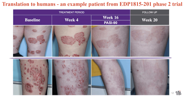 Example patient