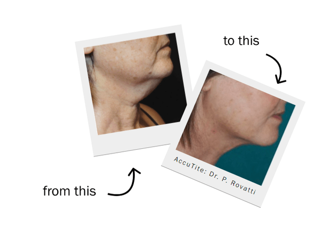 image of treatments before and after the procedure