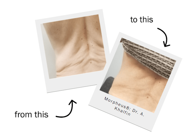 image of treatments before and after the procedure