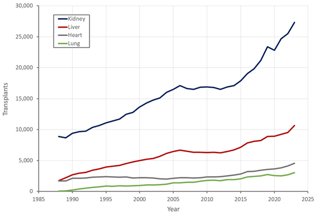 Organ Transplants in the US