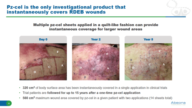Pz-cel efficacy in large RDEB skin wounds