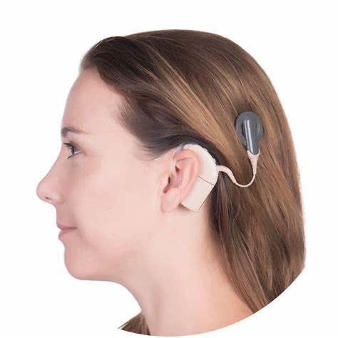 Cochlear Implants | Sensorineural Hearing Loss | Envoy Medical