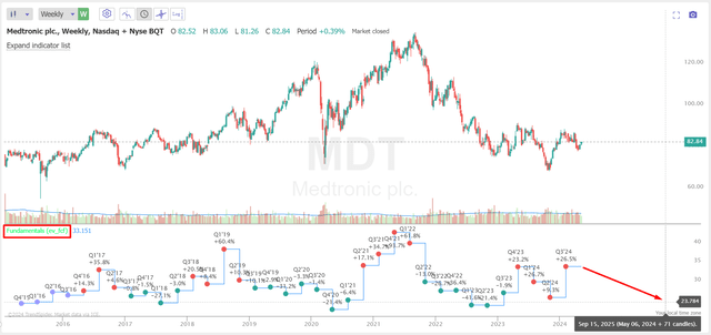 TrendSpider Software, MDT, the author's notes