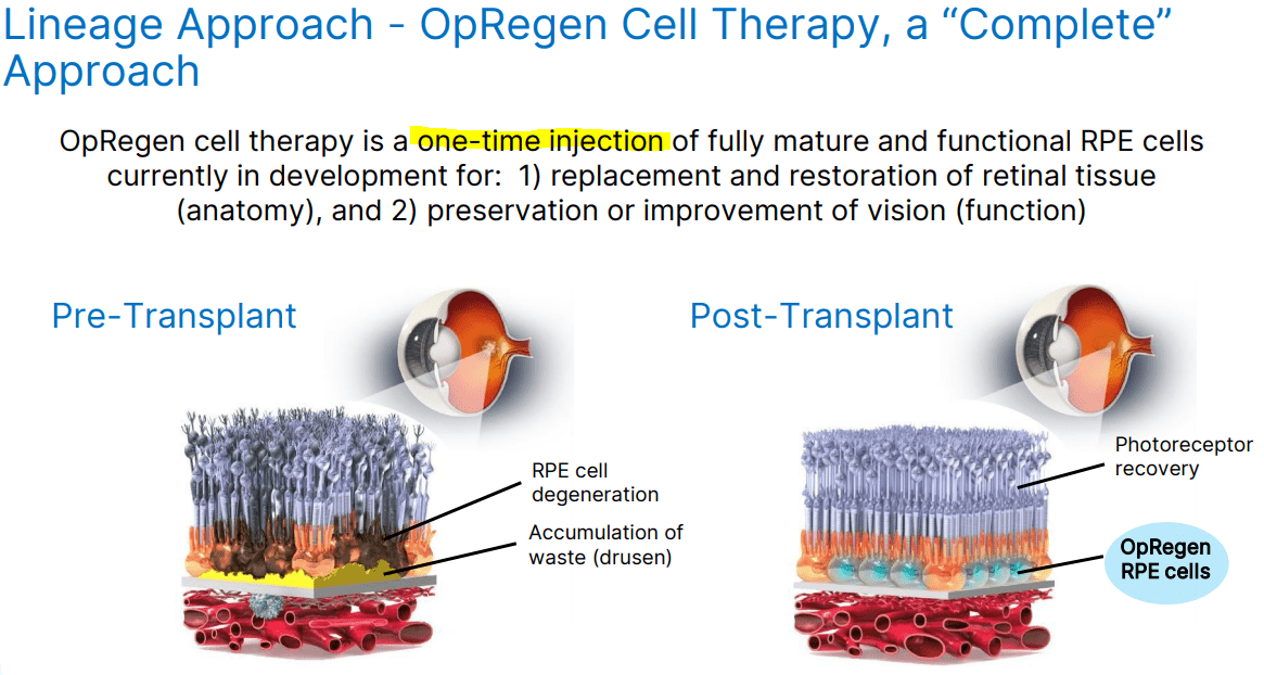 Opergen Lineage Cell Therapeutics Stock: OpRegen Makes It A Viable Speculative ...