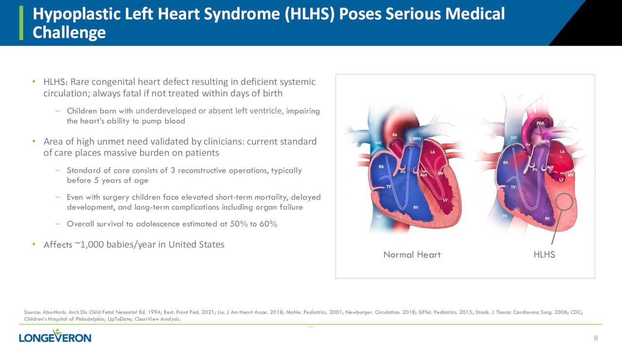 Hypoplastic Left Heart Syndrome (HLHS) Poses Serious Medical
