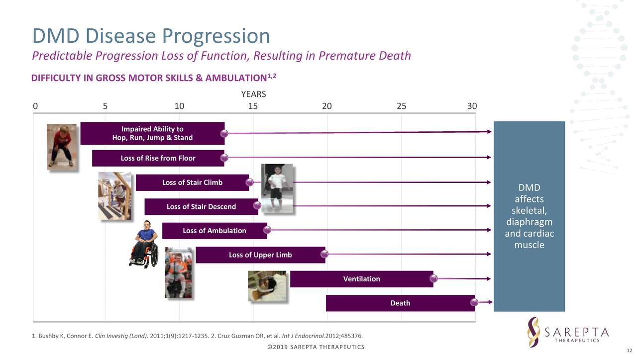 Sarepta Therapeutics (SRPT) Presents At Annual Meeting of the American