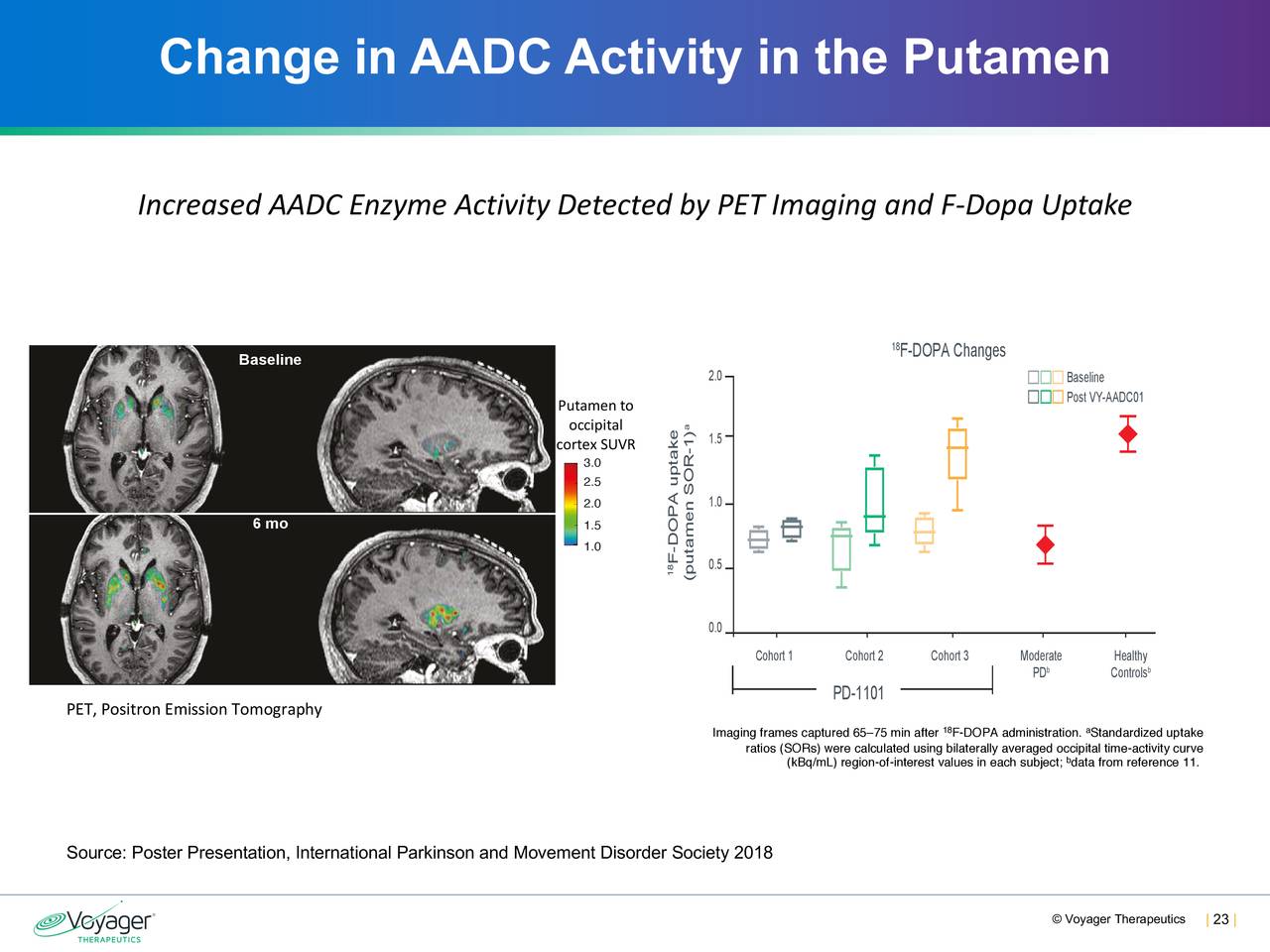 Change in AADC Activity in the Putamen