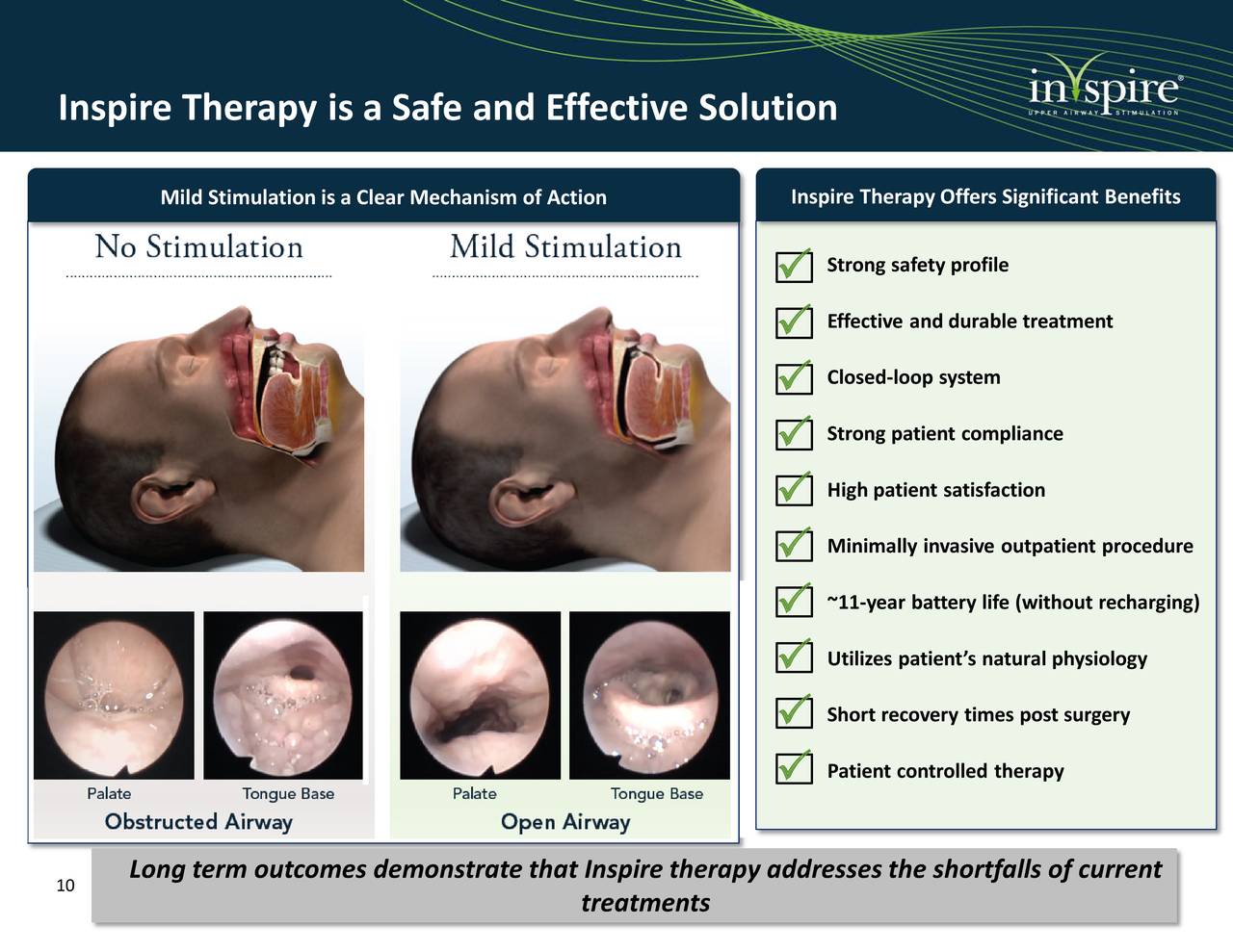 Inspire Medical Systems (INSP) SVB Leerink 8th Global Healthcare Conference (NYSEINSP