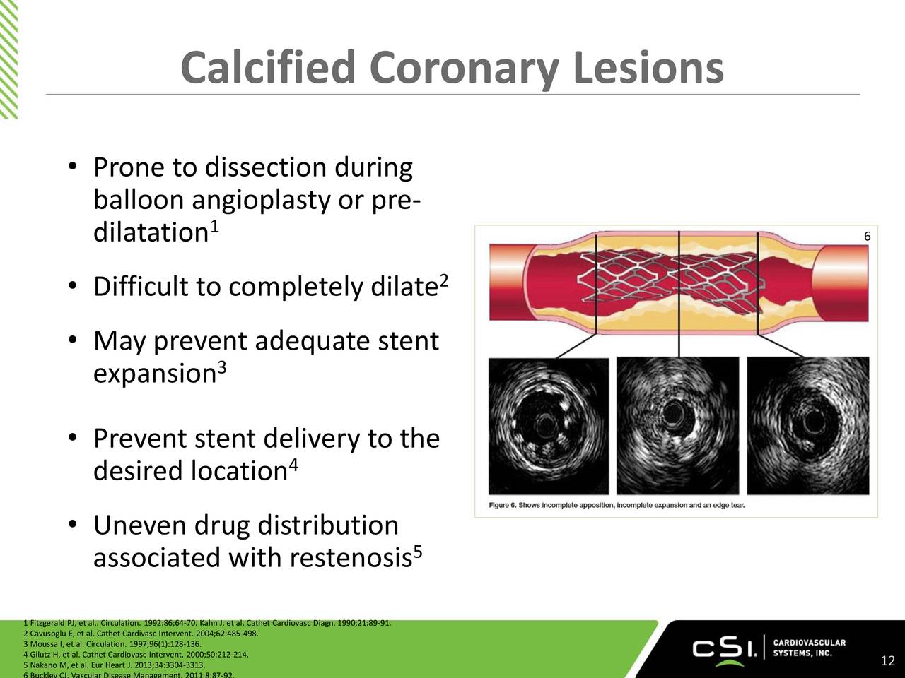 Cardiovascular Systems (CSII) Presents At Barclays Global Healthcare ...